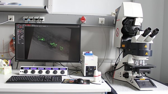 Gezeigt wird ein Bild des Konfokalen Laser-Mikroskops.